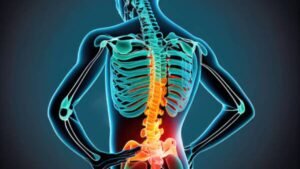 Office Chair Syndrome: Sitting Disease Unveiled! Why Your Chair Might Be Harming Your Bones, Know How It Affects Your Body