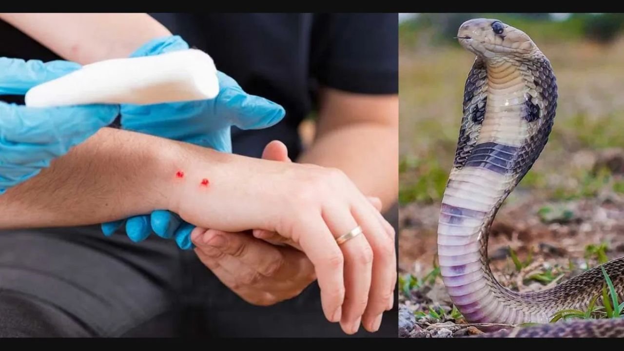 First Aid For Snake Bite: What to Do Immediately After a Snake Bite! Life-Saving Tips Everyone Should Know