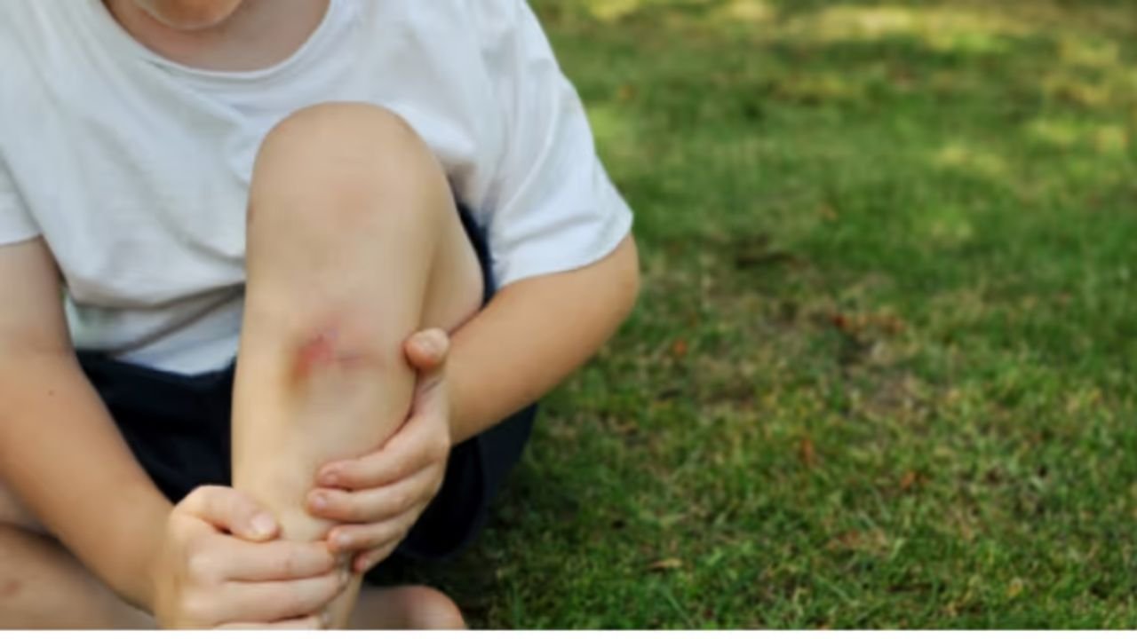 Health Tips: Does your skin get scars without injury? Find out what deficiency is causing this!