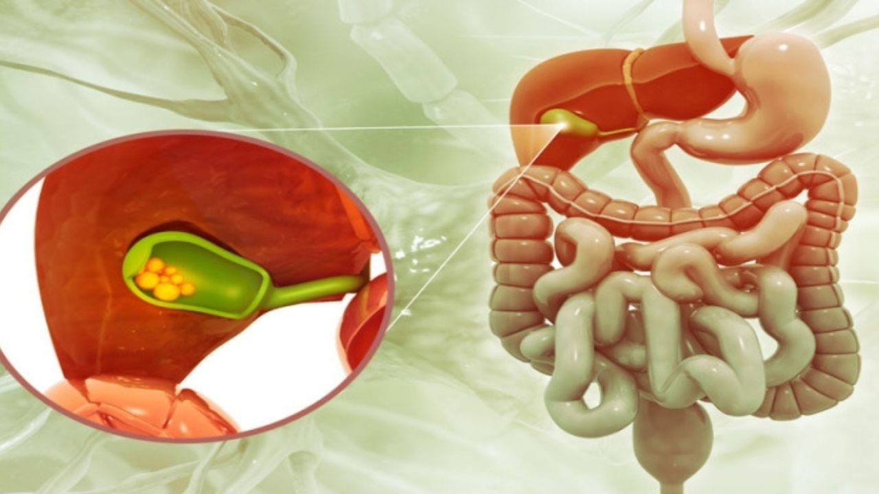 If you want to avoid gallbladder stones, then immediately give up these 5 bad habits, otherwise the risk will increase!