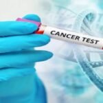 Cancer Test At Home: The secret to prevent cancer, do this test at home once a month, life can be saved in time