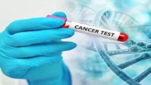 Cancer Test At Home: The secret to prevent cancer, do this test at home once a month, life can be saved in time