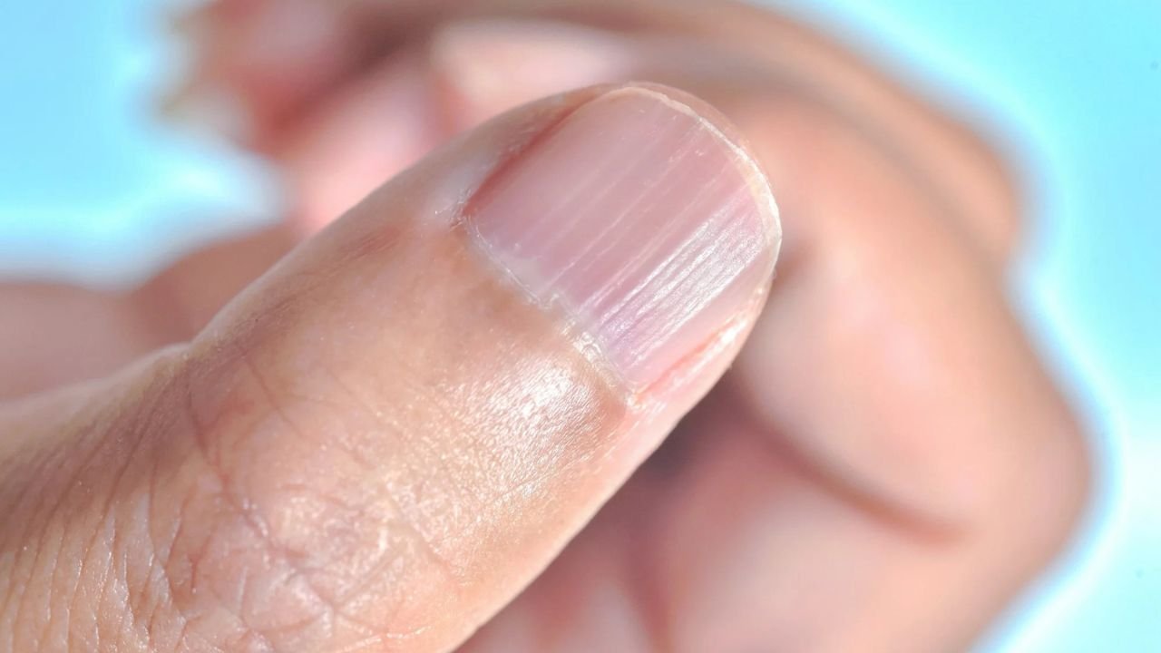 Line On Nails: Are your beautiful nails losing their shine? These health problems could be the reason behind them breaking, turning yellow, or turning black.