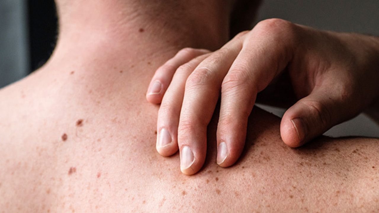 Skin cancer isn't easy to spot, but these 5 signs could save your life. Get tested immediately.