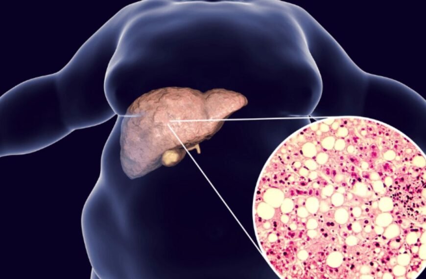 Fatty liver is not normal! If you notice these subtle symptoms, you should know the danger is upon you.