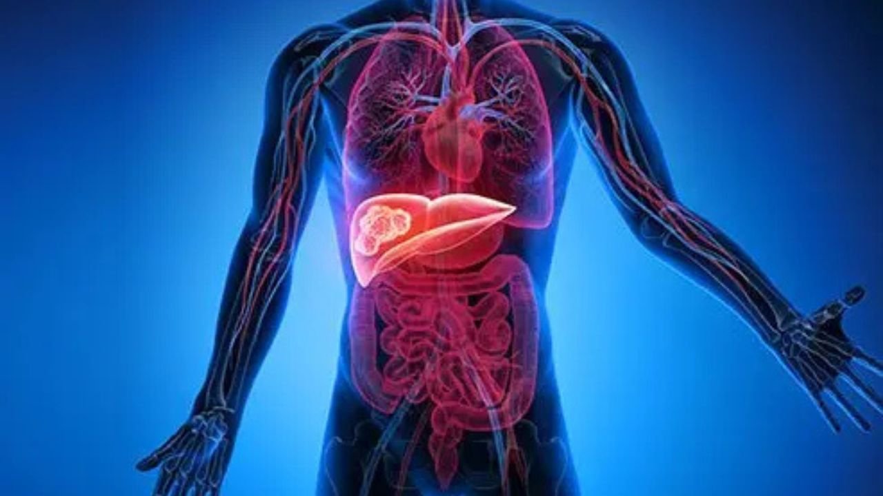 Liver Cancer Symptoms: The real cause of liver cancer? The biggest danger lies in your plate!