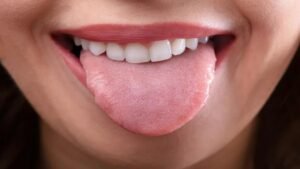 Tongue Color Symptoms: Is your tongue signaling danger? 5 scary reasons behind the color change