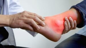 Elevated uric acid levels can increase the risk of kidney stones and joint problems.