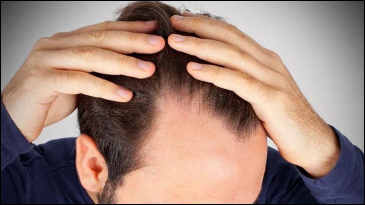 Hair Health Signs: Is sudden hair loss a warning sign? It could be a sign of a hidden illness in your body.