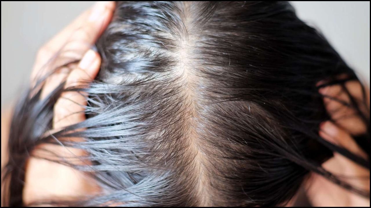 Hair Health Signs: Is sudden hair loss a warning sign? It could be a sign of a hidden illness in your body.