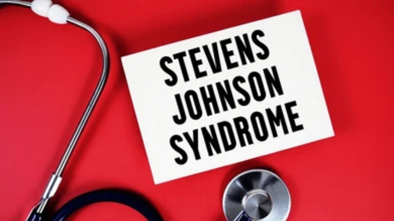 Blind Trust in AI HIV Advice Sends Man Into Critical Stevens-Johnson Syndrome Emergency