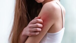 Is Vitamin Deficiency Causing Your Itching? Experts Reveal Shocking Skin Secrets