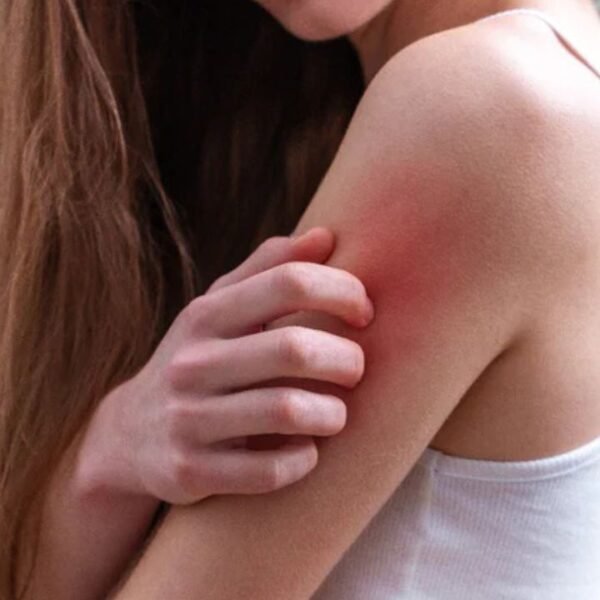 Is Vitamin Deficiency Causing Your Itching? Experts Reveal Shocking Skin Secrets