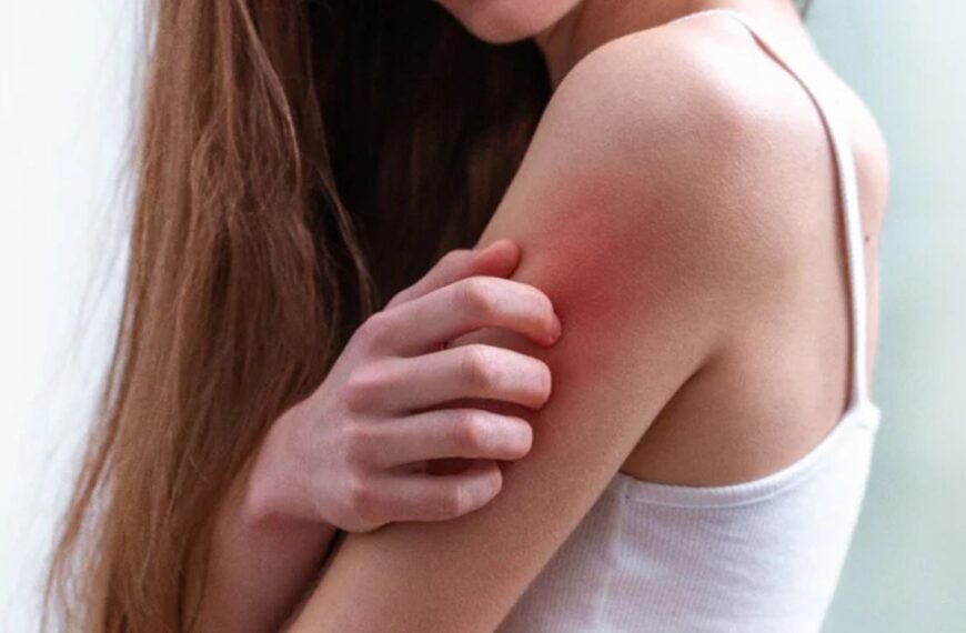 Is Vitamin Deficiency Causing Your Itching? Experts Reveal Shocking Skin Secrets