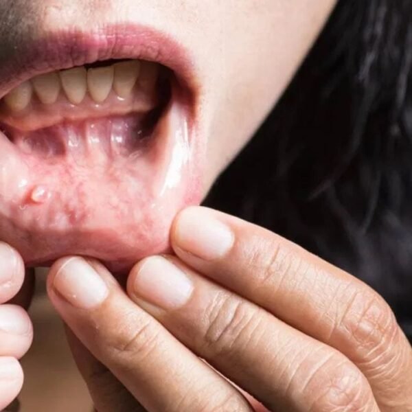 Cancer’s Early Warning Signs Are Easily Missed—Learn What Doctors Want You to Know