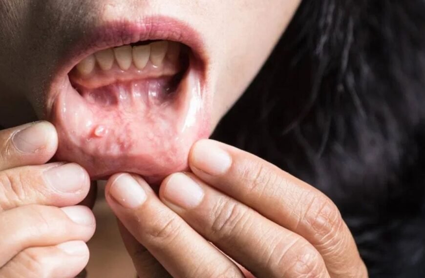 Cancer’s Early Warning Signs Are Easily Missed—Learn What Doctors Want You to Know