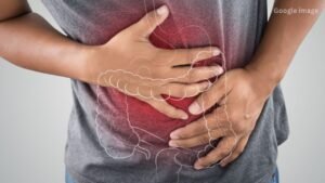 IBS Symptoms You Should Never Ignore Experts Warn About Silent Digestive Disease
