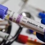 New AHA and ACC Cholesterol Guidelines Warn Young Adults of Rising Heart Risks