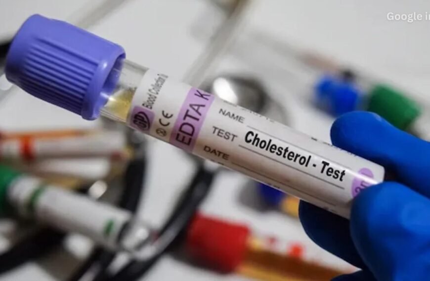 New AHA and ACC Cholesterol Guidelines Warn Young Adults of Rising Heart Risks