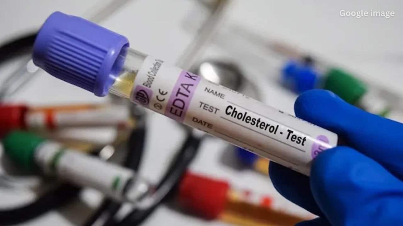 New AHA and ACC Cholesterol Guidelines Warn Young Adults of Rising Heart Risks